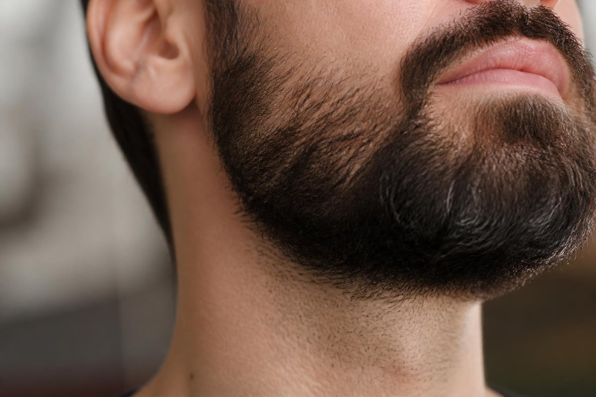 Sebaceous gland oil production versus beard length requirements