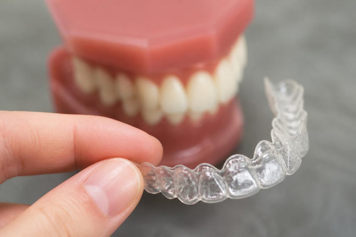 Progression of tooth movement with clear aligners