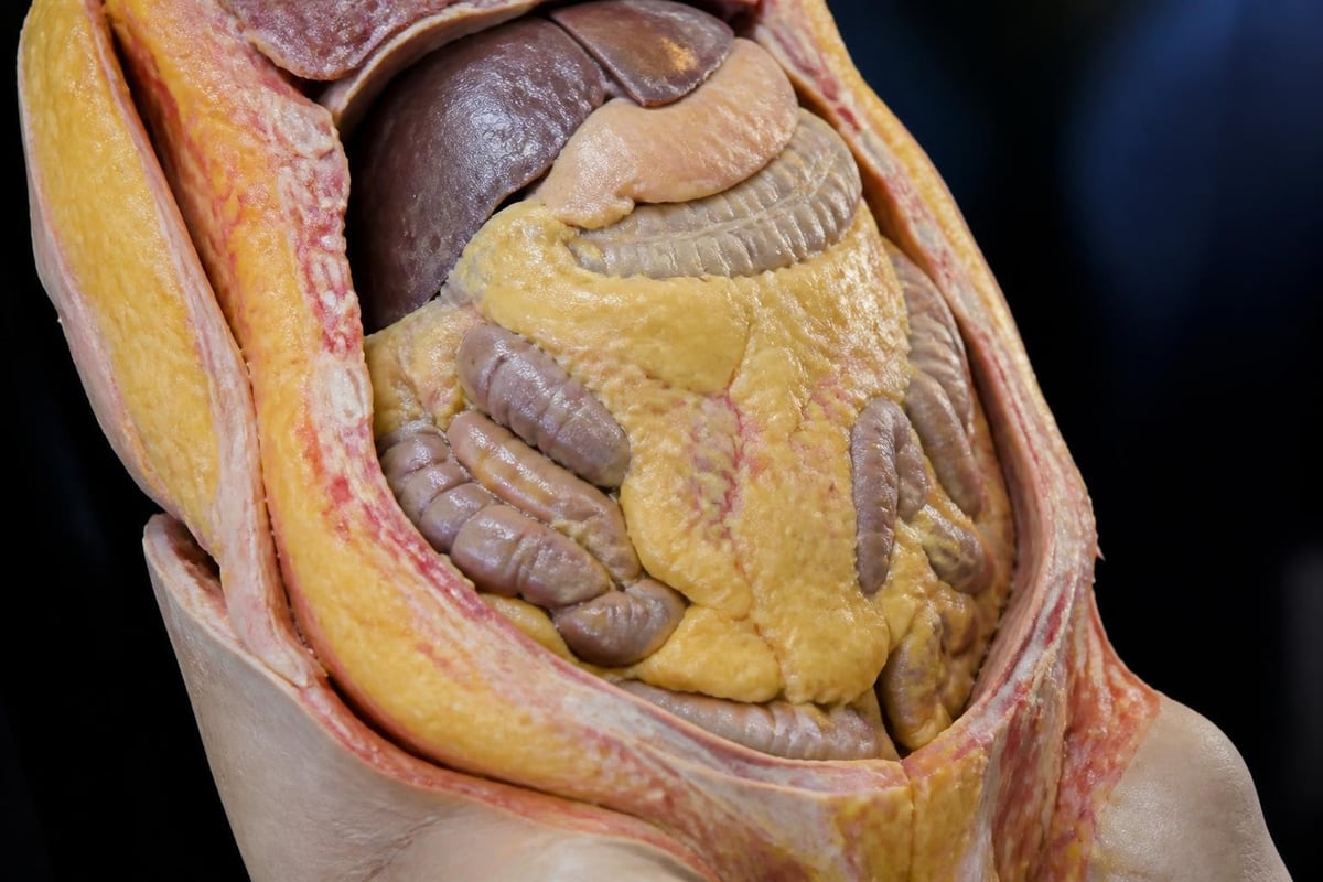 Visceral fat around organs