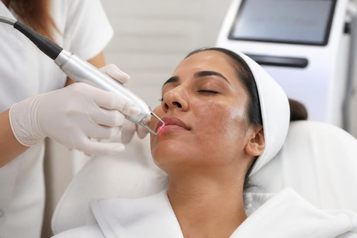 Pico laser treatment protocol