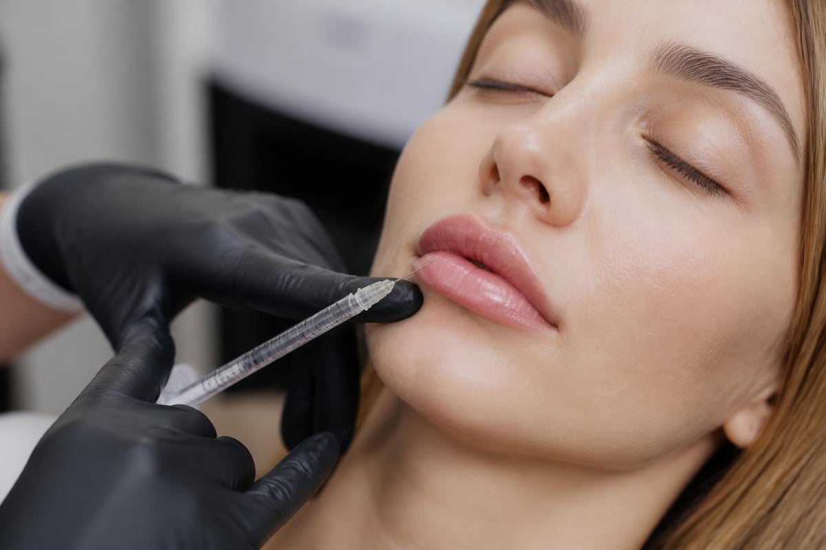 Upper lip anatomy