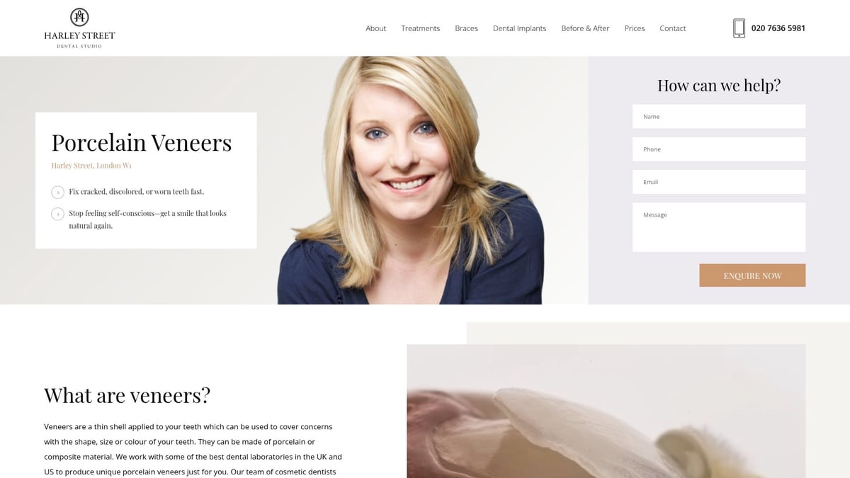 Best veneers near me provides an overview of the veneers options available locally