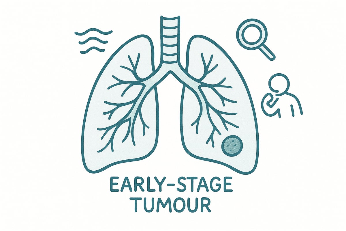 Understanding 1st Stage Lung Cancer