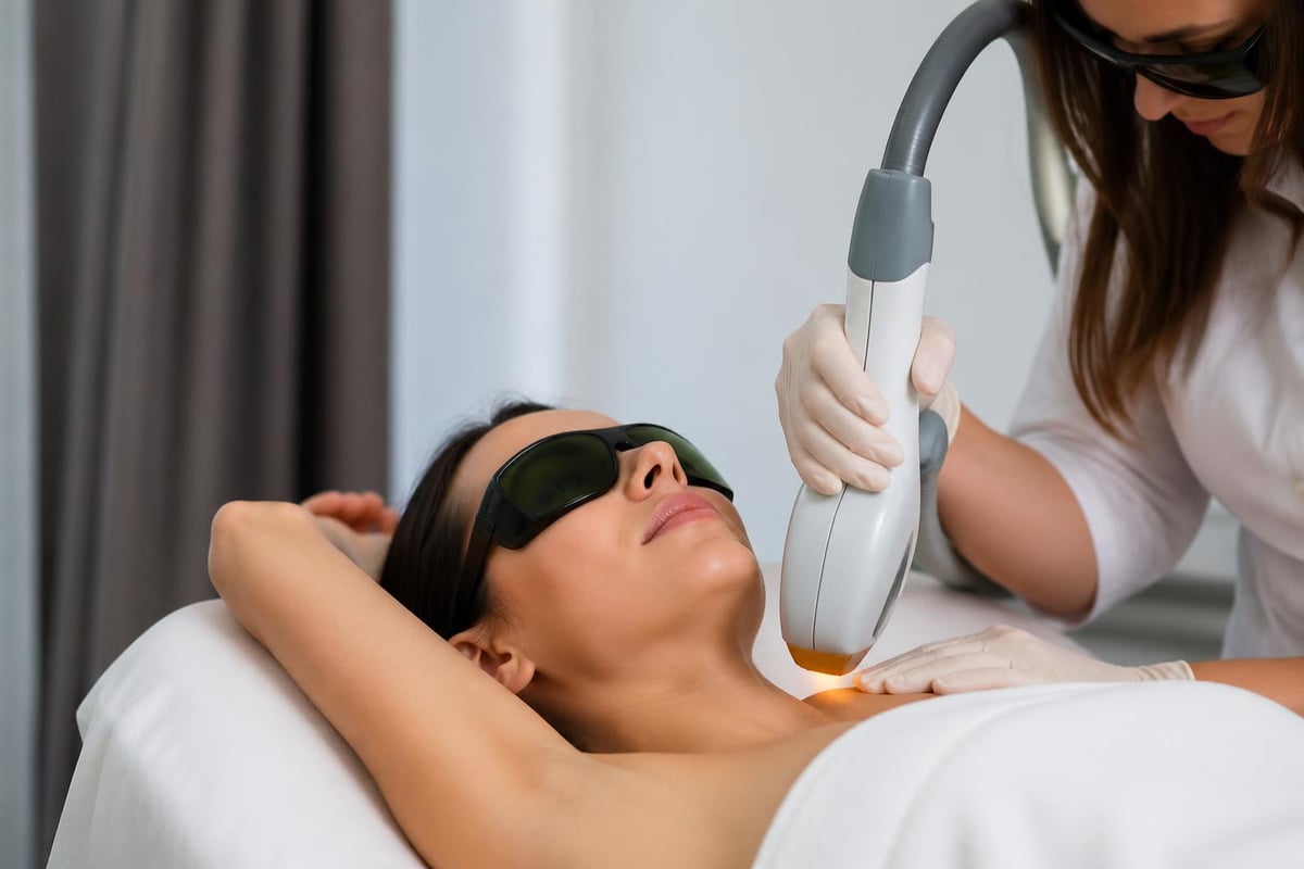 Laser hair removal technology