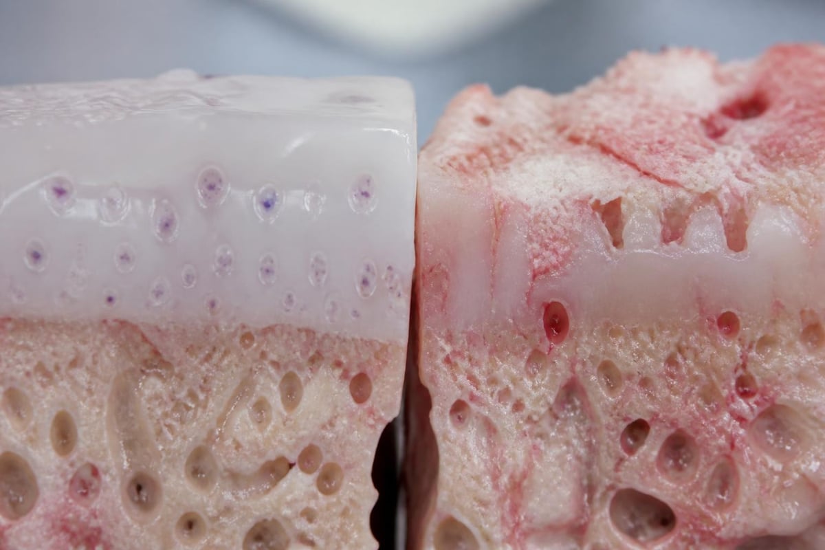 Cartilage tissue structure