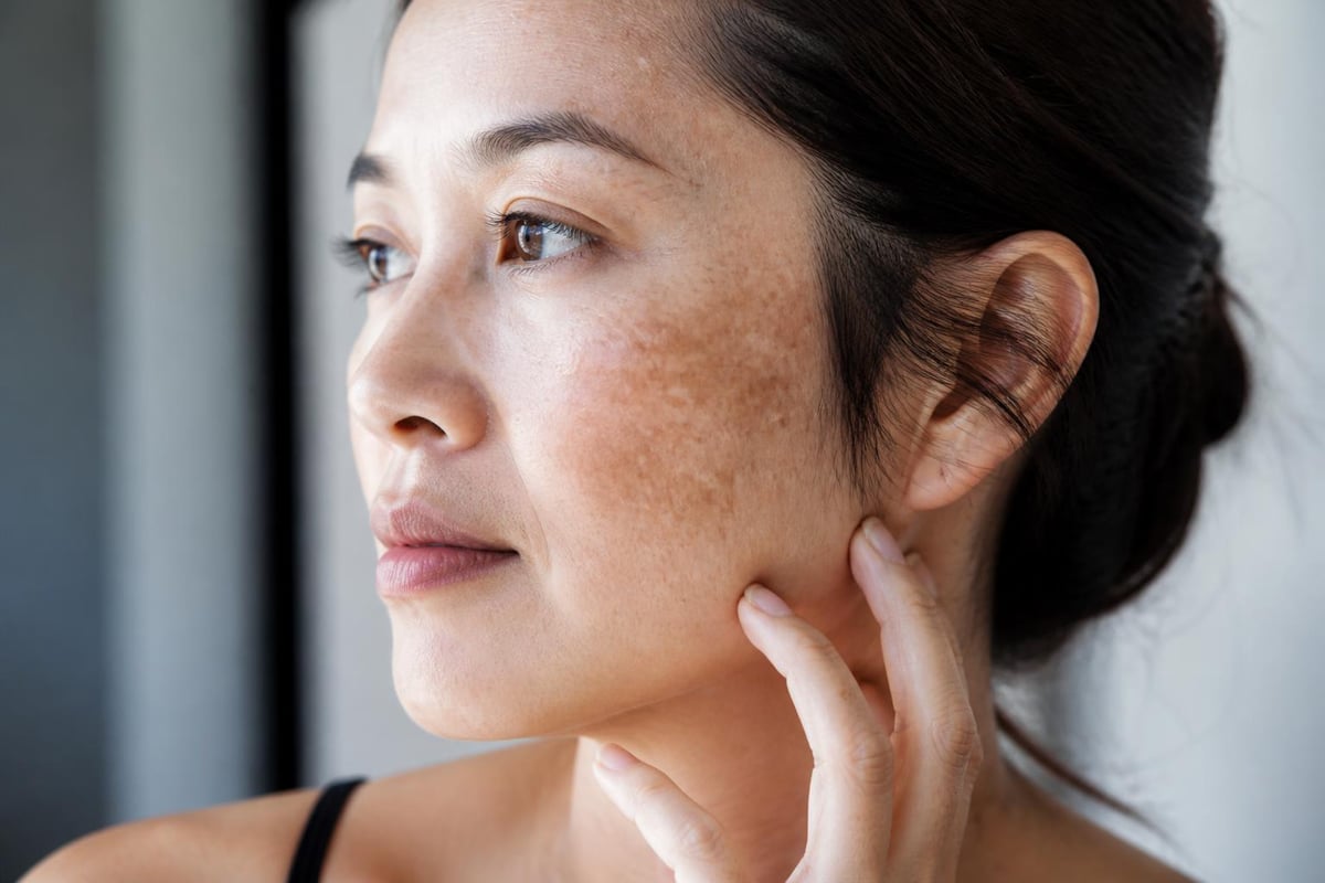 Skin conditions treated