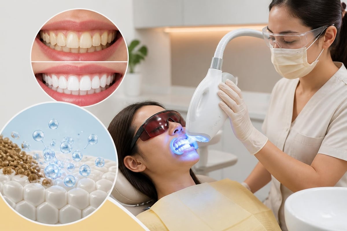 Chemical whitening process