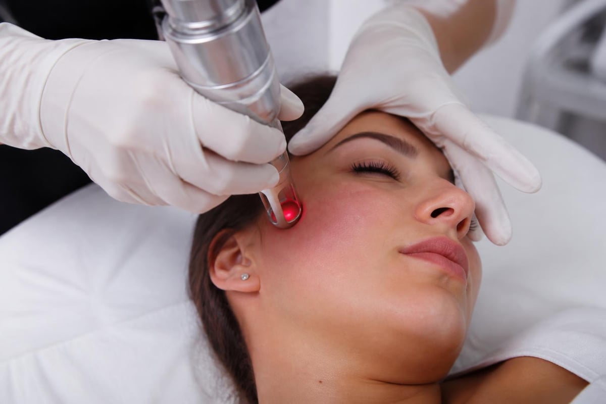 Fractional laser treatment pattern