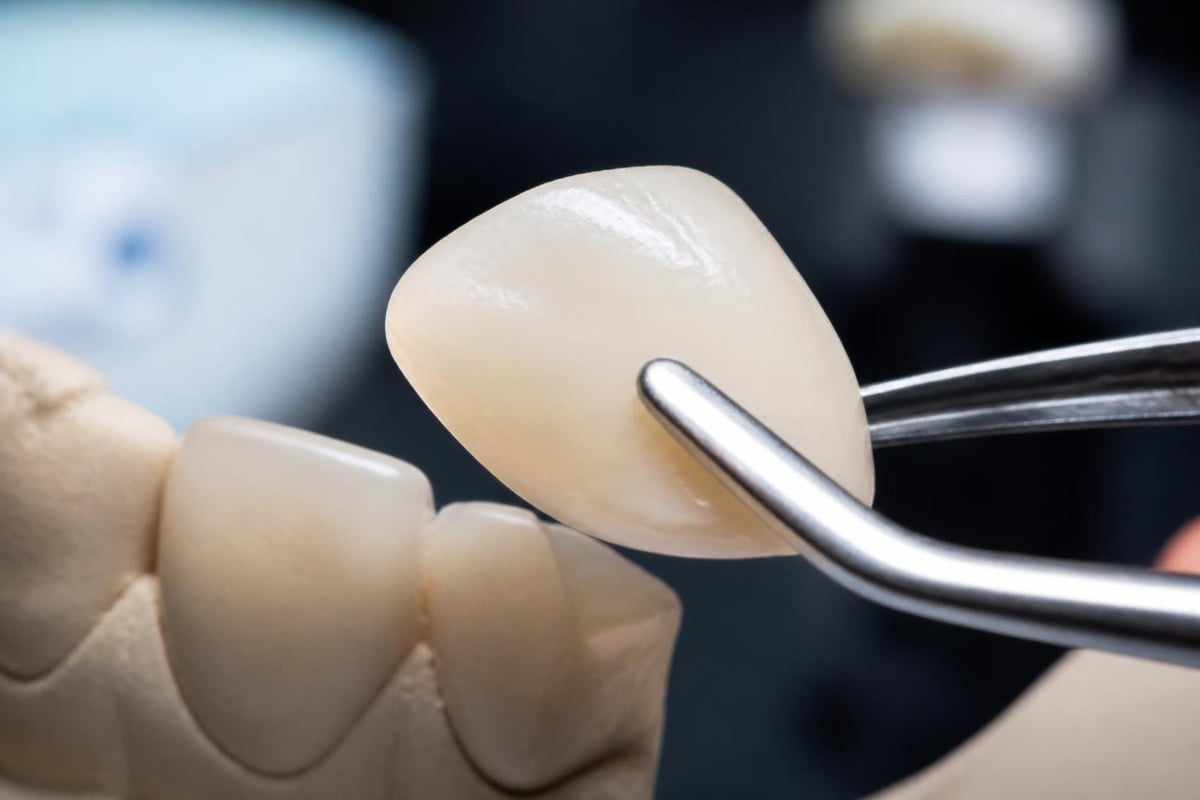 Composite veneer material structure