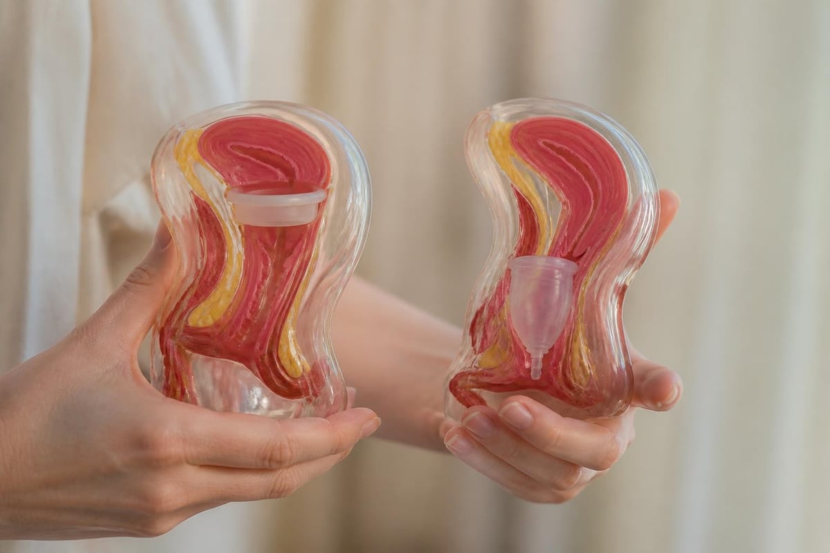 Menstrual disc versus menstruationskop