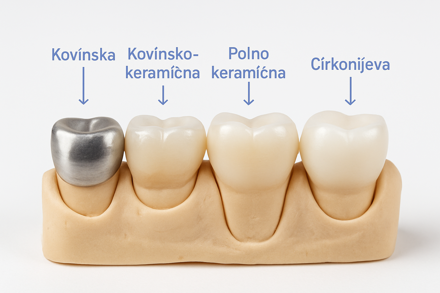 Prednosti in slabosti posameznih vrst prevlek