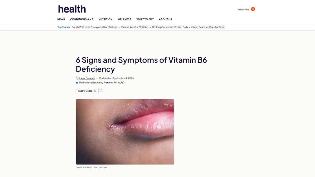 Top 8 Supplements for Anxiety: Natural Relief in 2026 - Vitamin B6 (Pyridoxine)