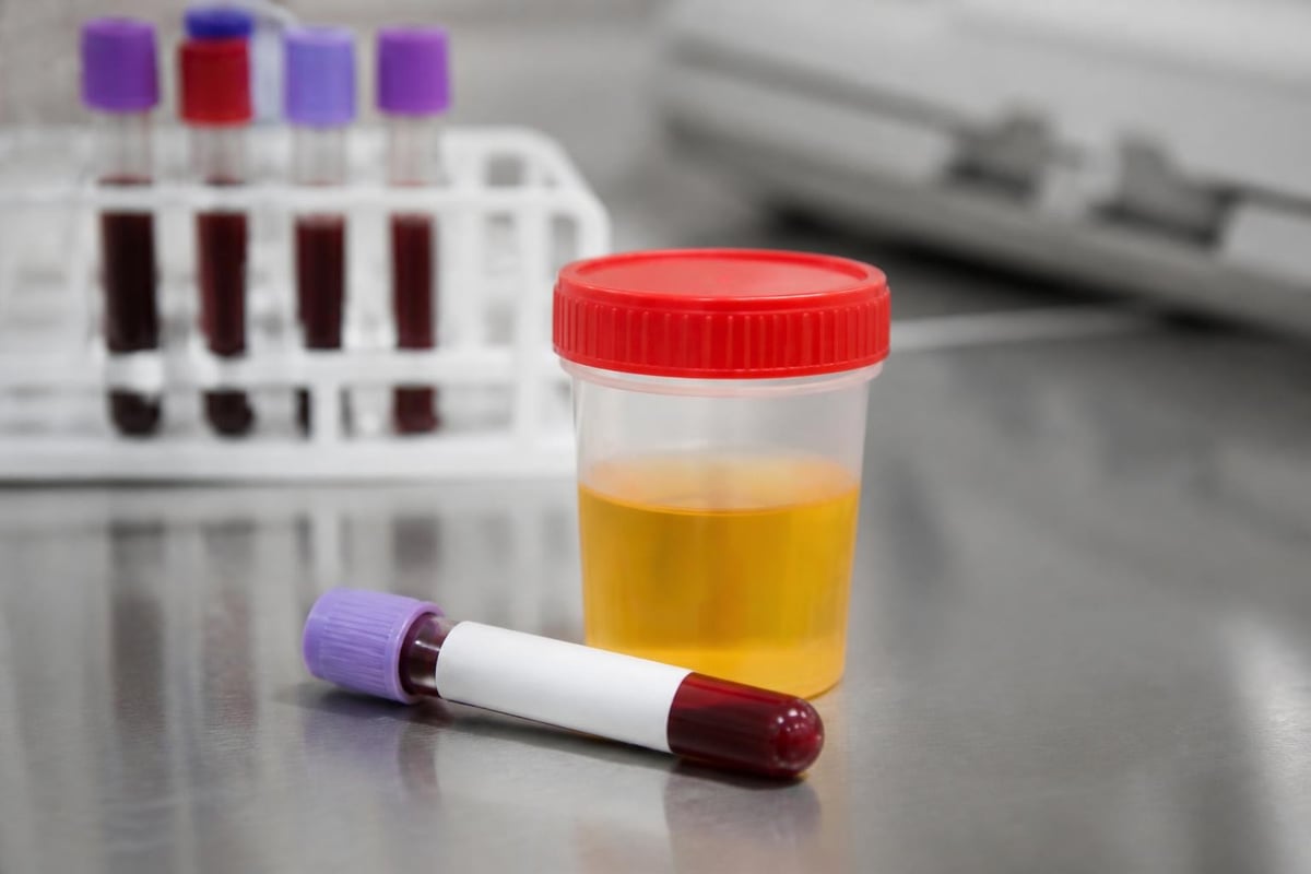 Steroid detection timeline