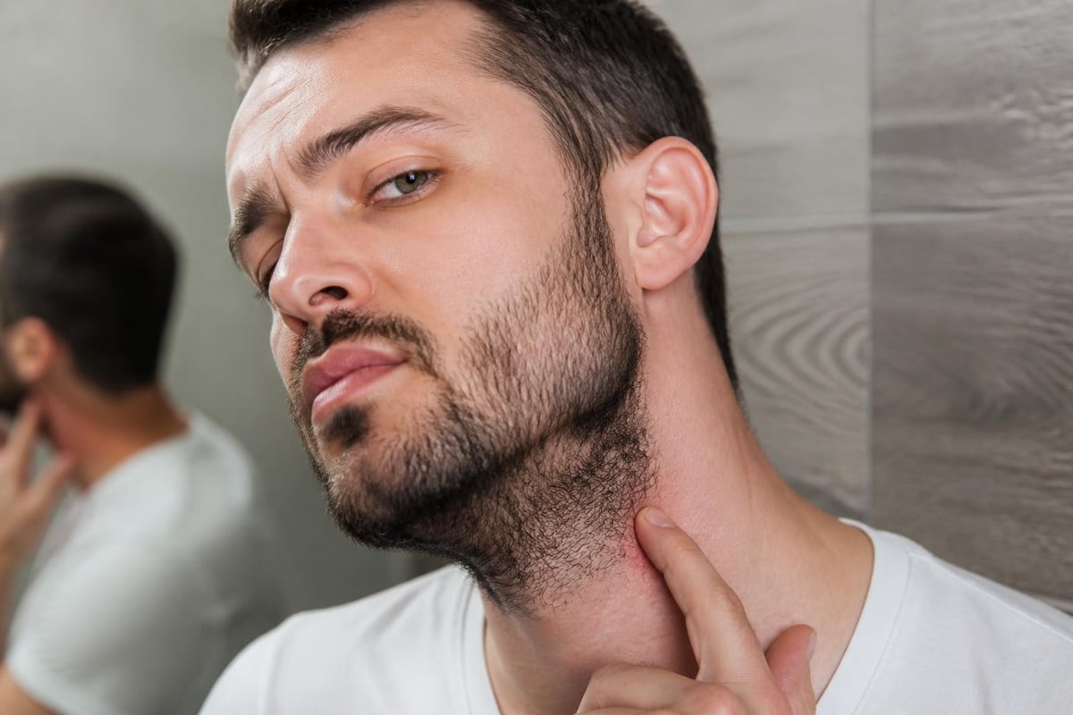 Beard trimming problems