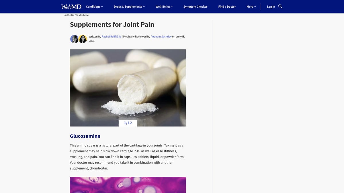 Top 7 Joint Supplements to Support Mobility in 2025 - Glucosamine & Chondroitin Complex