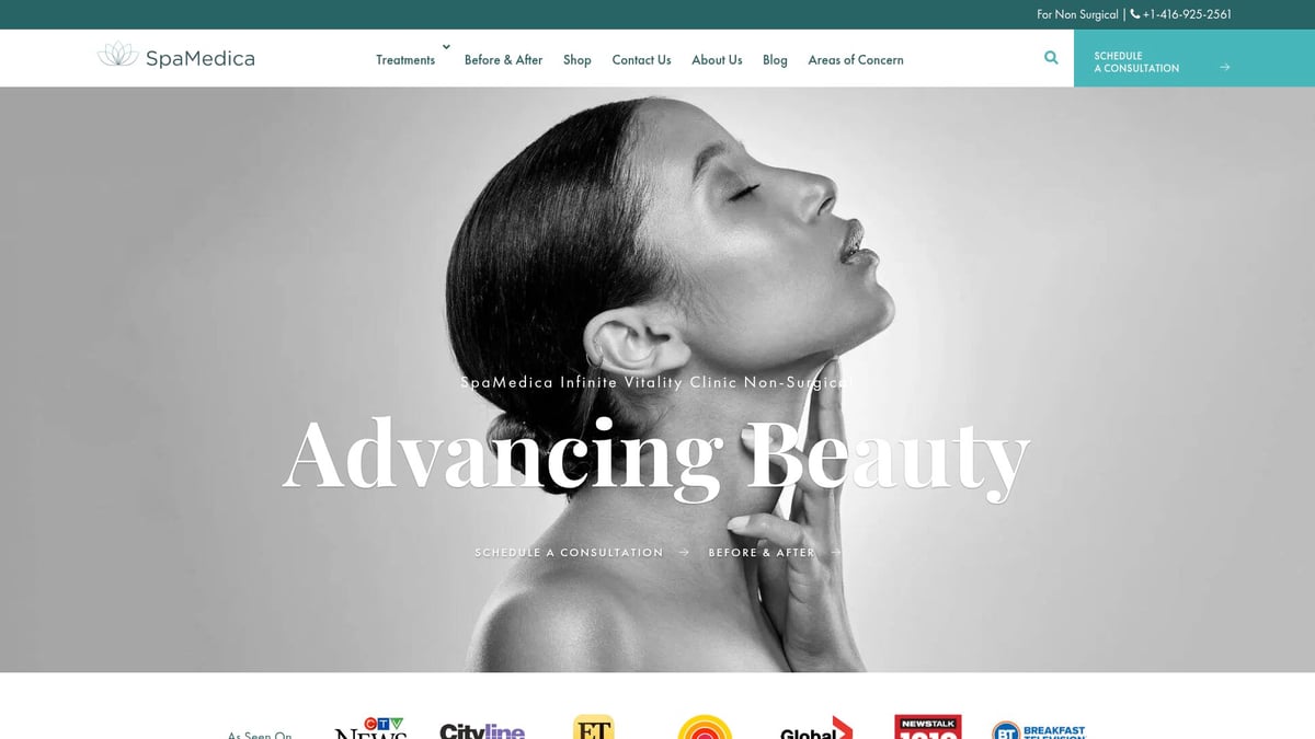 9 Must-Try Laser Services Near Me for Amazing Results in 2026 - Vbeam Prima Pulsed Dye Laser (SpaMedica)