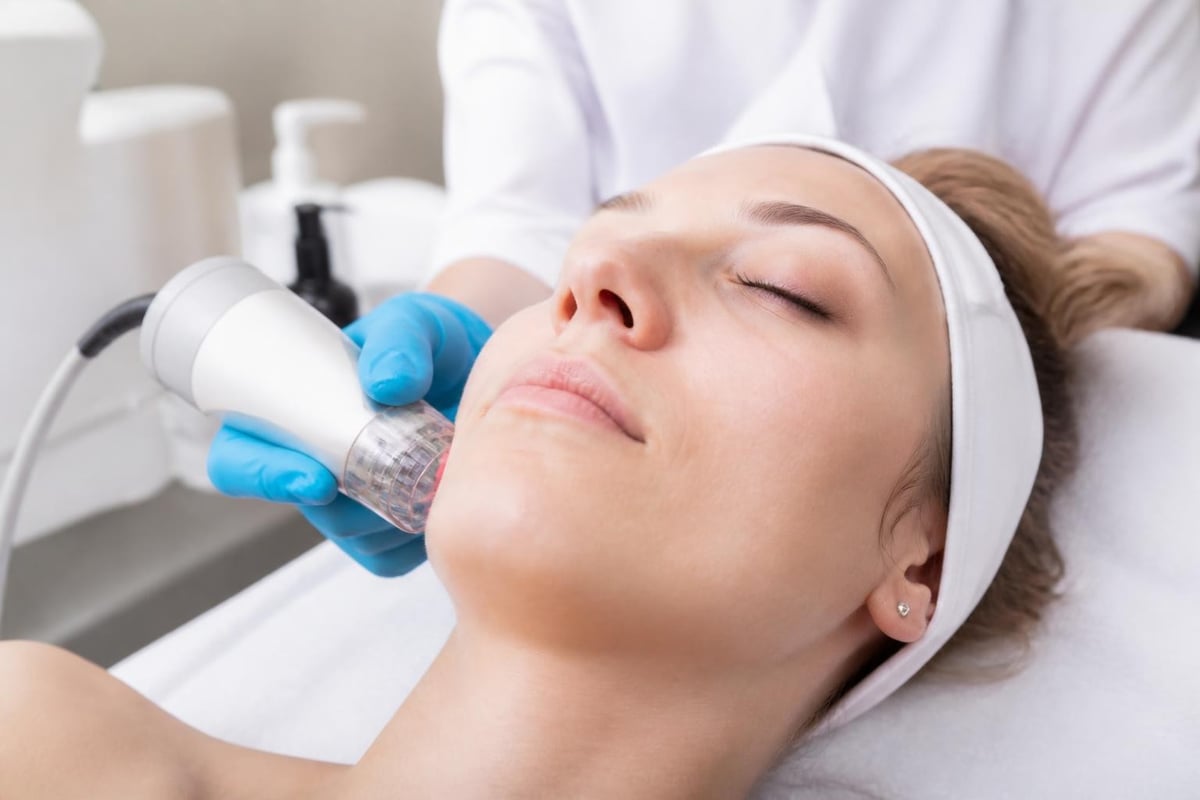 RF microneedling process