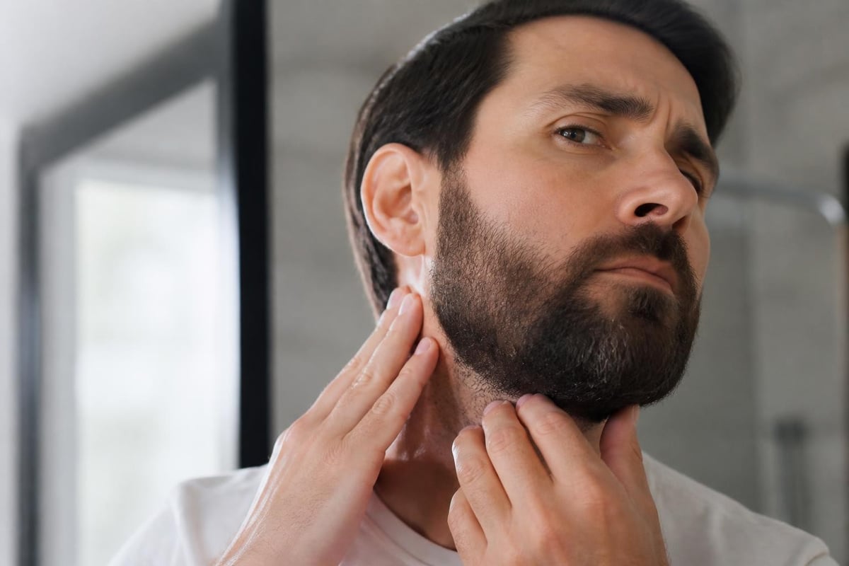 Beard itch biological process