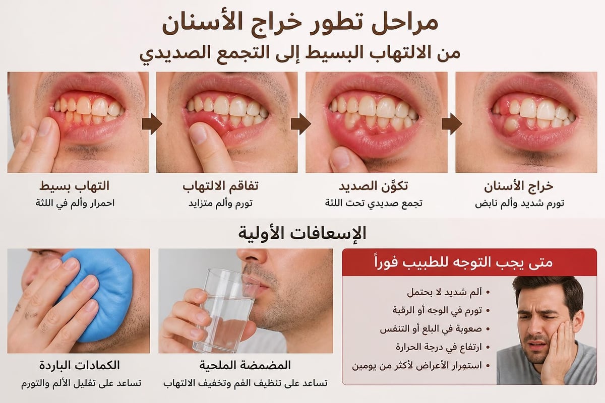 خطوات التعامل مع خراج الأسنان