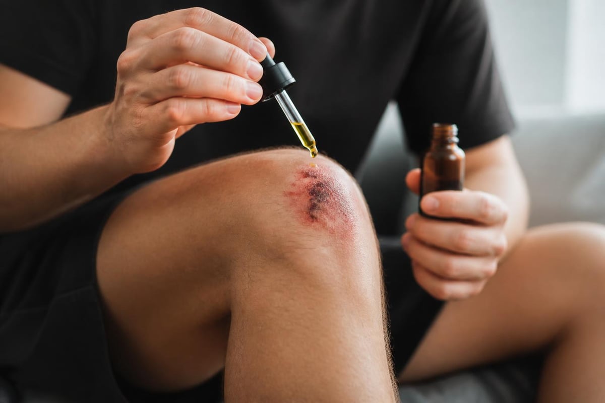 CBD mechanisms in tissue repair