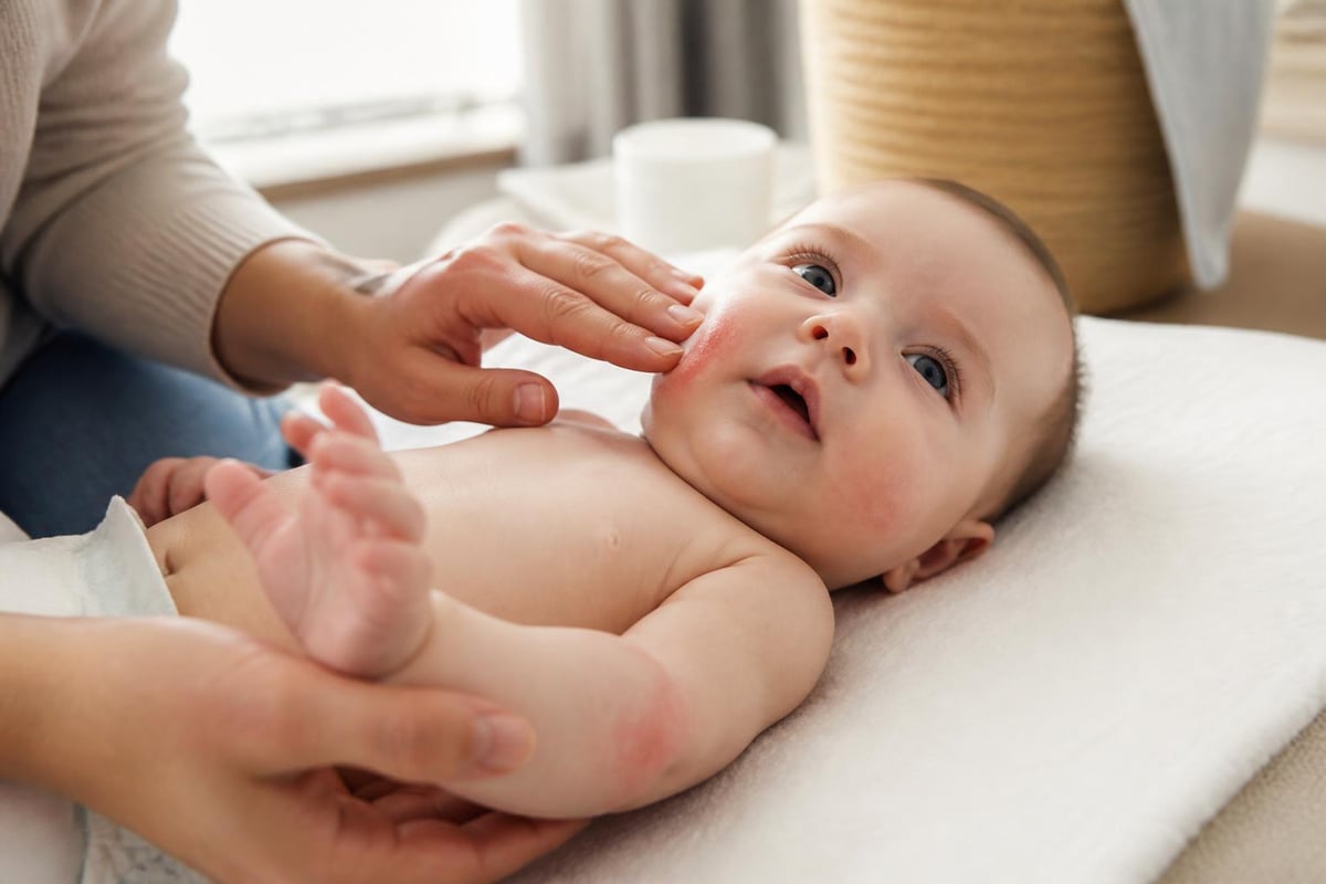Baby eczema cream application technique