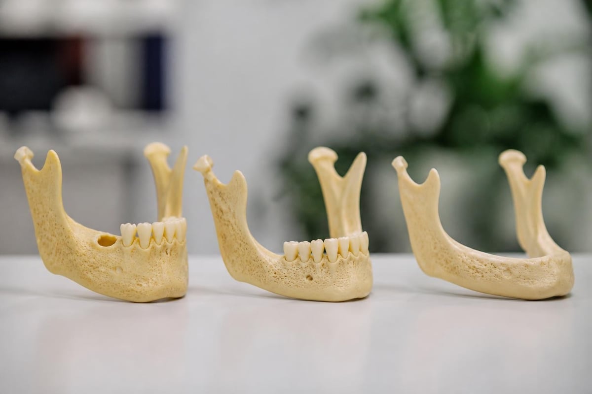 Bone resorption process timeline