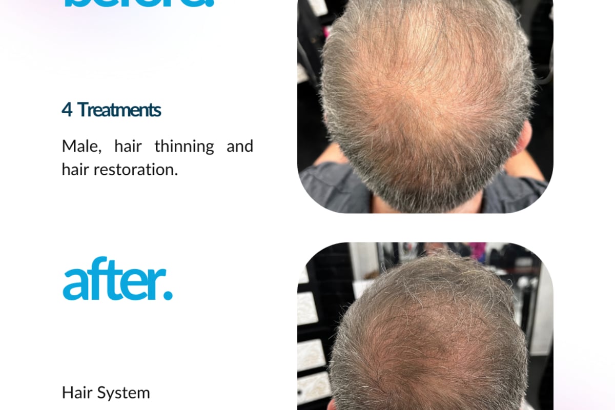 Pixie Garden Procell Hair Treatment - The Pixie Garden