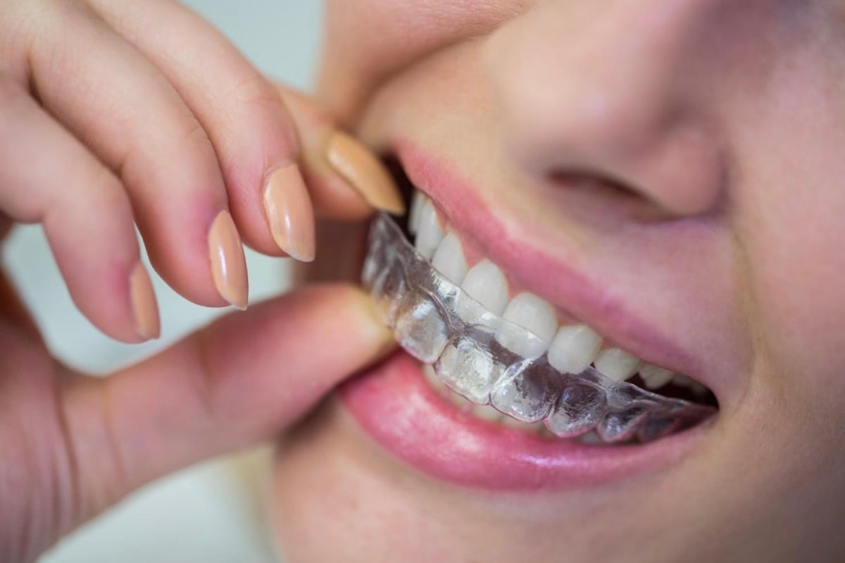 Clear Aligners & Orthodontics - CuraSmile PH