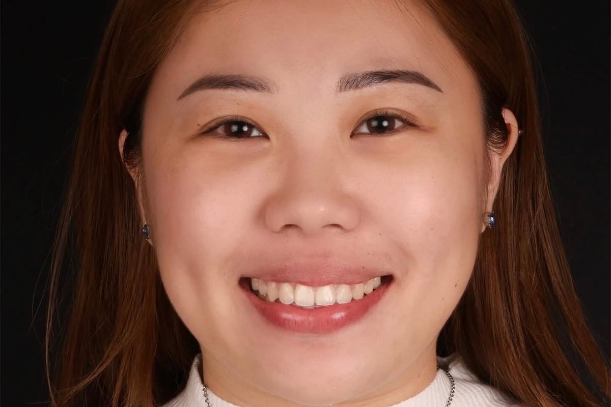 Clear Aligners & Orthodontics - CuraSmile PH